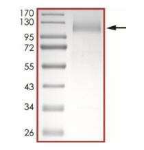 The purity of nCoV-S1 (T19R, G142D, ∆157-158, L452R, T478K, D614G, P681R) was determined to be >90% by densitometry